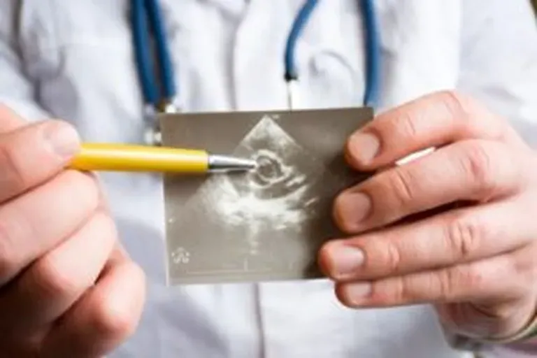 Mitral Valve Regurgitation