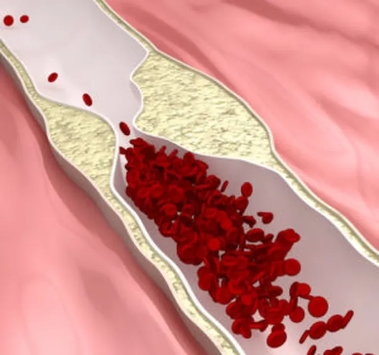 When to See Your Doctor for Leg Pain