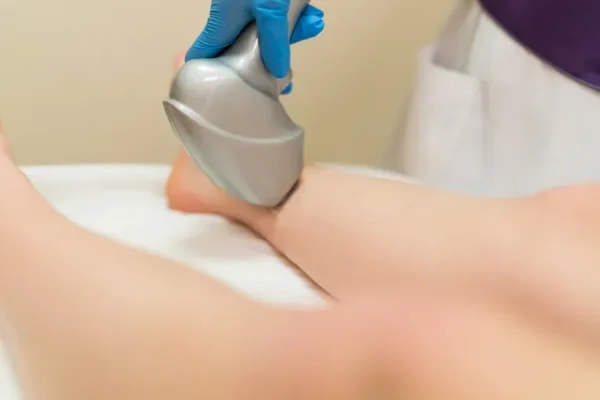 5 Benefits of Endovenous Laser Therapy